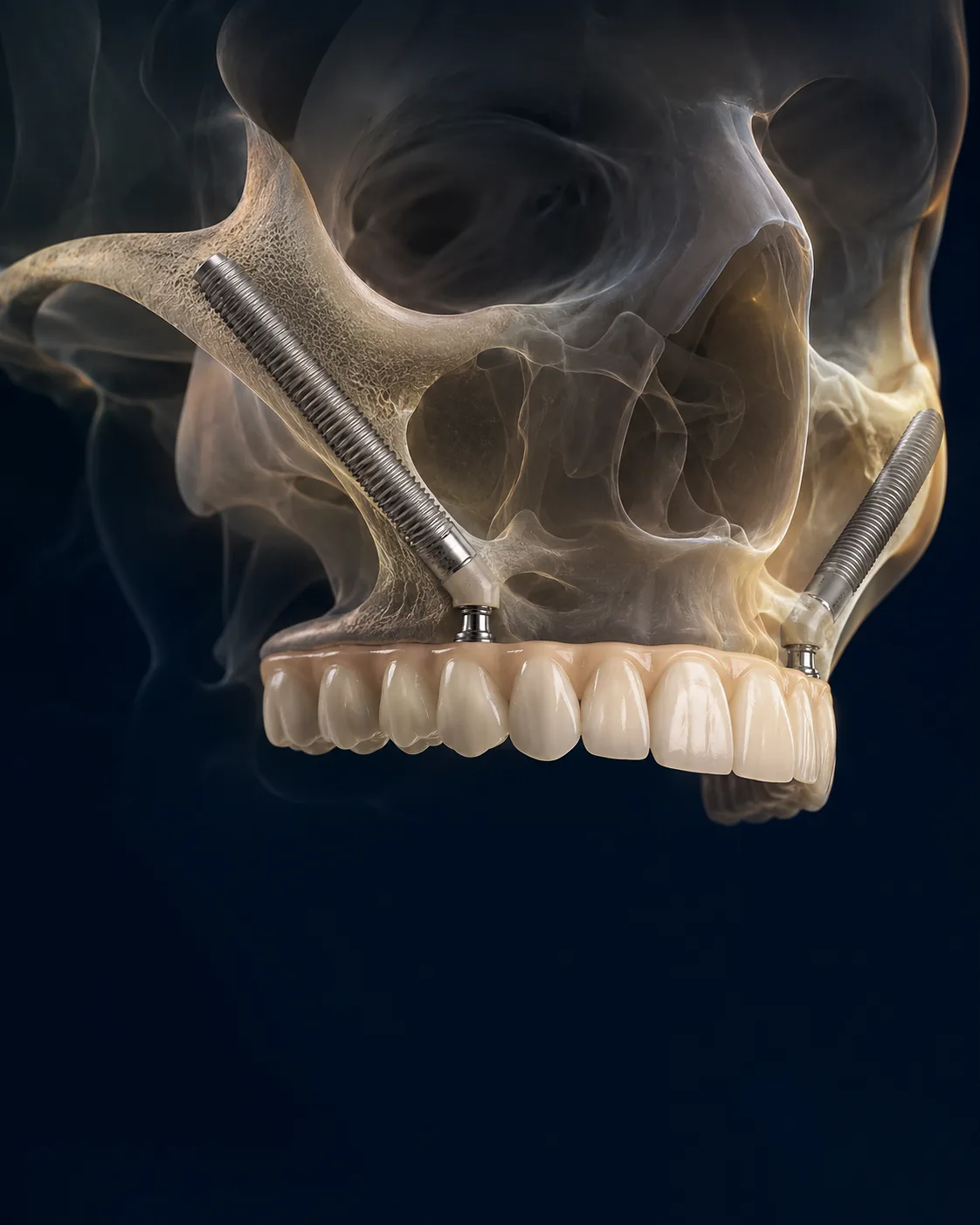 Advanced zygomatic implant treatment planning
